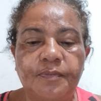Profissional - Elisabete D.