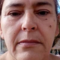 Profissional - Idalina R.