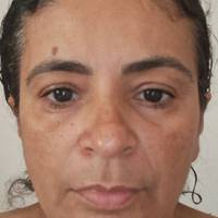 Profissional - Berenice S.