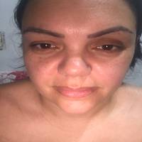Profissional - Renyelle B.