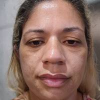 Profissional - Lilian O.