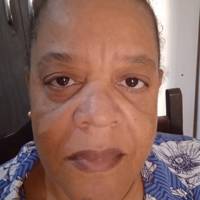 Profissional - Adelma M.