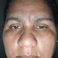 Profissional - Alzimar S.